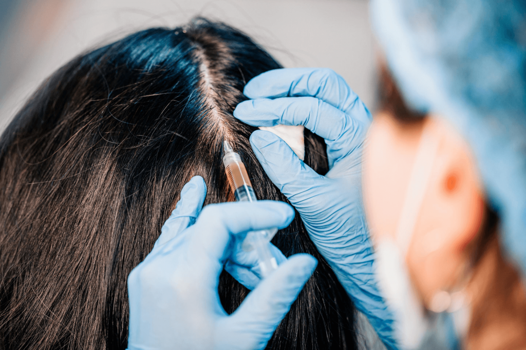 hair loss treatment for women