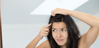 Can Dandruff Cause Hair Loss? Link, Cure And Prevention Can Dandruff Cause Hair Loss