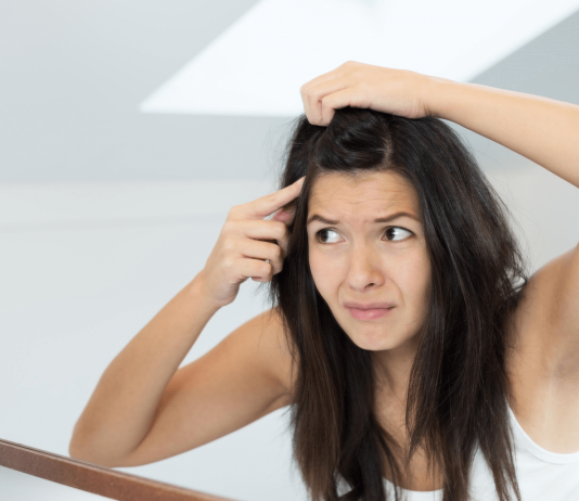 Can Dandruff Cause Hair Loss? Link, Cure And Prevention Can Dandruff Cause Hair Loss