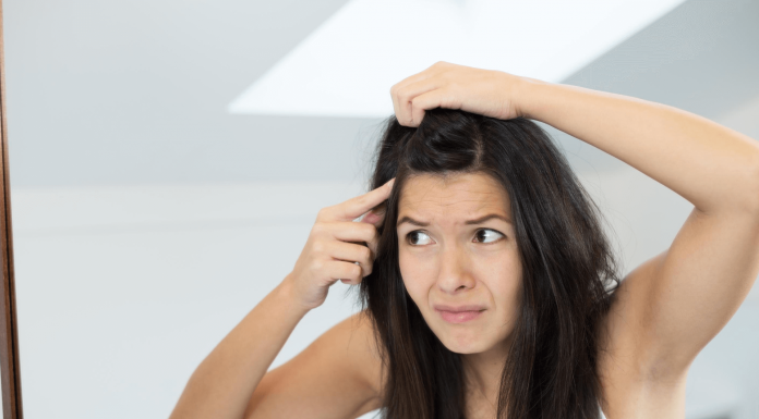 Can Dandruff Cause Hair Loss? Link, Cure And Prevention Can Dandruff Cause Hair Loss
