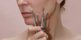 How To Get Rid of Acne Scab: The Do’s And Don’ts how to get rid of acne scab