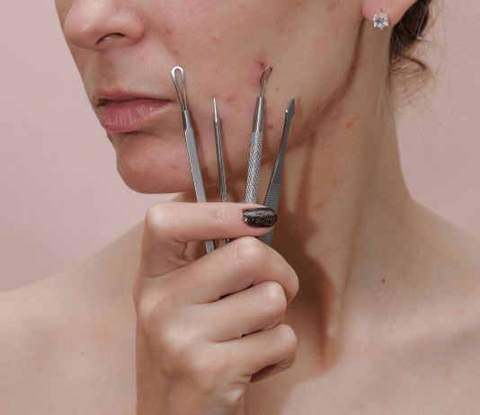 How To Get Rid of Acne Scab: The Do’s And Don’ts how to get rid of acne scab