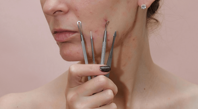 How To Get Rid of Acne Scab: The Do’s And Don’ts how to get rid of acne scab