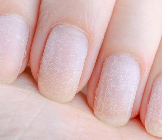 How to Remove Dip Powder Nails: 5 Methods You Must Know how to remove dip powder nails
