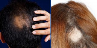 How To Cover Bald Spots With Makeup: 6 Most Effective Methods How To Cover Bald Spots With Makeup